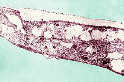 Bacteria 'treponema pallidum'