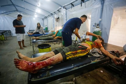 Un ni?o palestino recibe tratamiento este lunes tras un ataque israel en el centro de la Franja, en el campo de refugiados de Al Nuseirat.