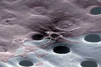 Clulas de la piel crecen sobre el material perforado HYAFF (abajo), de 20 micras de espesor, para regenerar la epidermis.