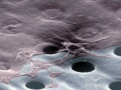 Células de la piel crecen sobre el material perforado HYAFF (abajo), de 20 micras de espesor, para regenerar la epidermis.
