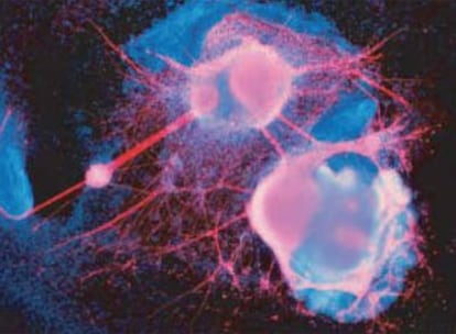 Análisis  por inmunofluorescencia de una  célula madre diferenciada.