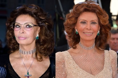 Sofia Loren ha tardado mucho en operarse y lo ha hecho a poco. La primera imagen es de 2013 y la otra, de 2014.