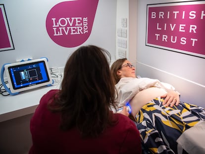 Unidad móvil de escaneo hepático del British Liver Trust en el Congreso Internacional del Hígado, celebrado en junio en Londres.