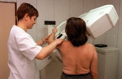 Exploración de mama en un centro especializado de Madrid.