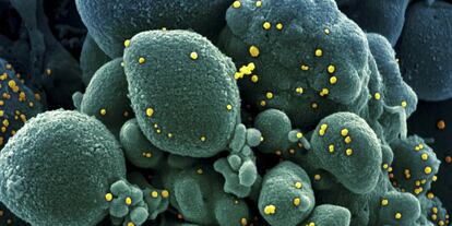 Una imagen del virus al microscopio.