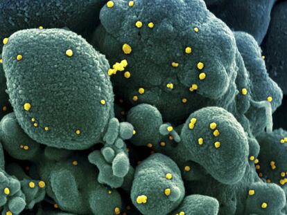 Una imagen del virus al microscopio.