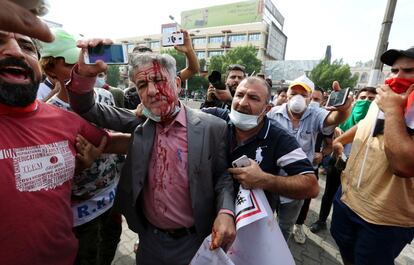 Estas manifestaciones son la reanudación de las protestas registradas a principios de octubre para pedir servicios básicos y más empleo, además de condenar la corrupción, y en las que murieron 157 personas, la mayoría a causa de la represión policial. En la foto, uno de los heridos durante las marchas en Bagdad
