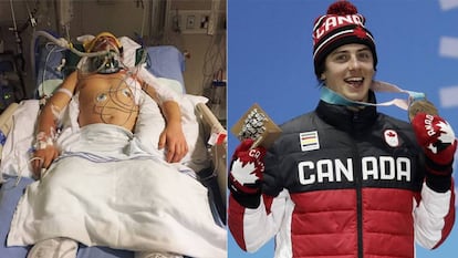 Mark McMorris, en el hospital en 2017 y este domingo celebrando su bronce en PyeongChang. 