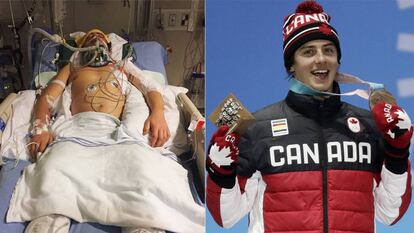 Mark McMorris, en el hospital en 2017 y este domingo celebrando su bronce en PyeongChang.