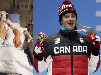 Mark McMorris, en el hospital en 2017 y este domingo celebrando su bronce en PyeongChang. 