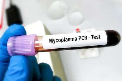 mycoplasma