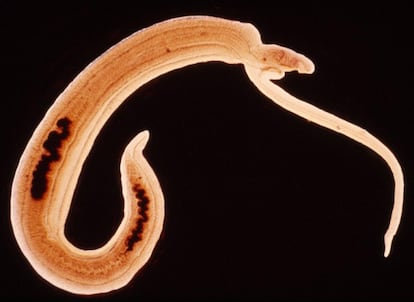 Dos gusanos 'Schistosoma haematobium'.