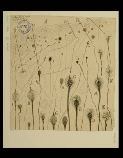 Una ferida cerebral de gos, de Ramón y Cajal.