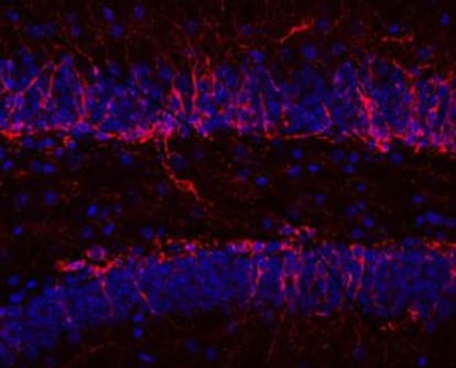 Imagen de nuevas neuronas jóvenes (marcadas en rojo) que nacen continuamente en el cerebro adulto y que conviven con neuronas ya maduras (en azul).