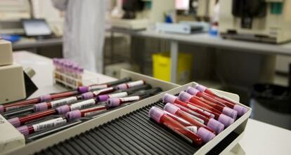 Muestras de sangre en un laboratorio.
