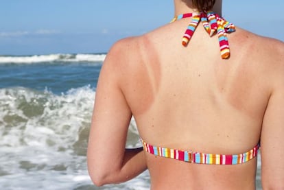 Learning how to correctly apply sunscreen can save us from burns and other skin problems.