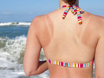Learning how to correctly apply sunscreen can save us from burns and other skin problems.