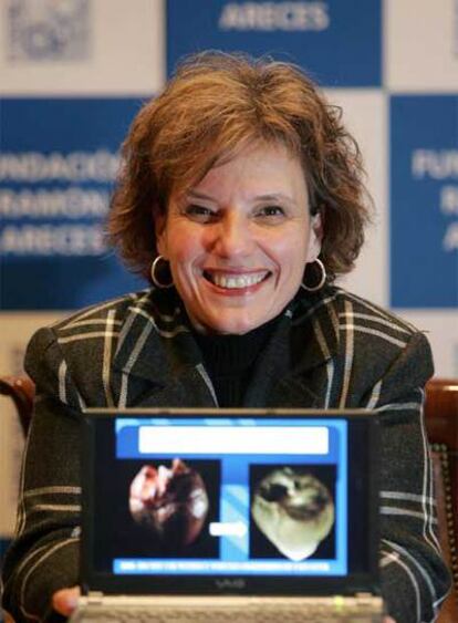 Doris Taylor, la científica que dirige el equipo que estudia la creación del primer corazón artificial con células madre.
