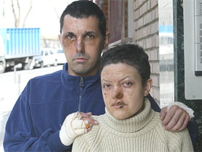 José Ramón Veiga y Sonia Yagüe, heridos en los atentados de Atocha, al salir de su domicilio de Vallecas para ir al médico.