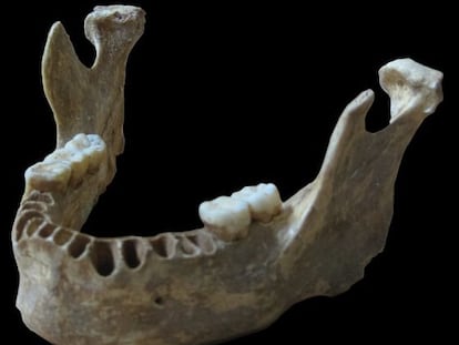 La mandibula &#039;Oase 1&#039;, hallada en 2002 en la cueva rumana de Pestera cu Oase.
 