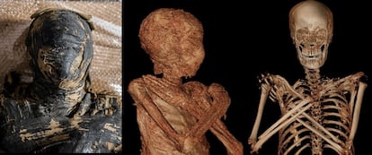 Tres imágenes del estudio de la momia.