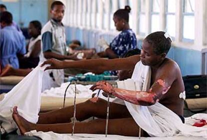 Jane, recepcionista del hotel Paraíso de Mombasa, en el hospital donde se recupera de las heridas sufridas en el atentado del pasado jueves.