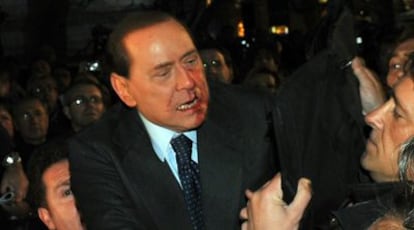 Silvio Berlusconi, con la cara ensangrentada, tras ser golpeado en Milán.