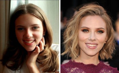La rinoplastia de Scarlett Johansson parece una de las más obvias entre las famosas. Su rostro actual es muy parecido al de hace 15 años, pero el puente y la punta de su nariz son claramente diferentes. 