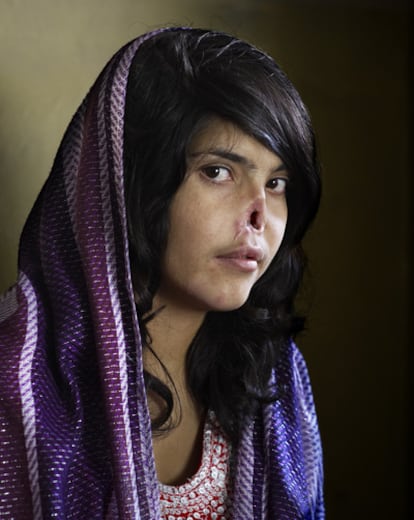 Aisha Bibi, una mujer de 18 años, de la provincia de Oruzgan, en Afganistán, huyó de la casa de su marido a la casa de su familia, quejándose del trato violento recibido. Los talibanes llegaron una noche, exigiendoque Bibi fuera ajusticiada. Poco después, un comandante talibán pronunció su veredicto, y mientras su cuñado la agarraba, el marido le cortó las orejas y la nariz. Aisha fue abandonada, pero más tarde fue rescatada por cooperantes y militares estadounidenses. Después de un tiempo en un refugio para mujeres en Kabul, fue llevada a Estados Unidos, donde fue tratada de sus heridas y sometida a cirugía reconstructiva. Aisha Bibi vive hoy en los EE UU (Artist Management/Goodman Gallery para TIME magazine).