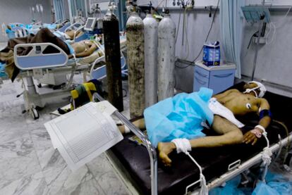 Heridos por los combates en una de las salas del hospital Shara Azzauiya, en Trípoli; en primer término yace un mercenario gadafista.