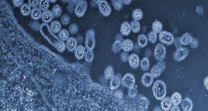 Virus H7N9 de gripe aviar saliendo de una célula.