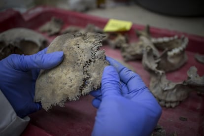 Los trabajos de restauración en los cráneos encontrados.