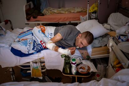 Anton Gladun, de 22 años, come en su cama en el Third City Hospital, en Cherkasi, Ucrania. 