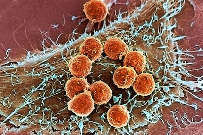 Linfocitos T (en naranja), adheridos a una célula tumoral.