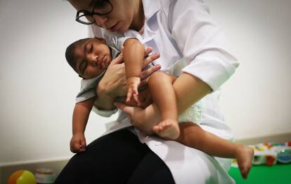 Médica faz terapia em bebê nascido com microcefalia.