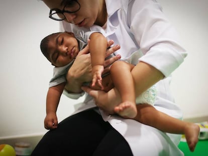 Médica faz terapia em bebê nascido com microcefalia.