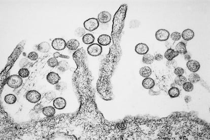 Así es el virus de los Andes, la única cepa de hantavirus que se transmite  de persona a persona | Salud y bienestar | EL PAÍS