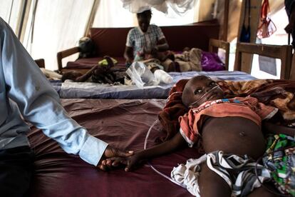 Un padre agarra la mano de su hijo desnutrido mientras este se recupera en un centro de rehabilitación de Tshikapa (República Democrática del Congo).