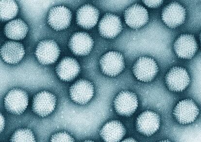 Adenoviruses under an electronic microscope.