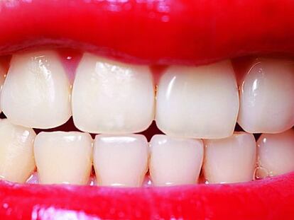 ¿Por qué amarillean los dientes a pesar de cepillarlos a diario?