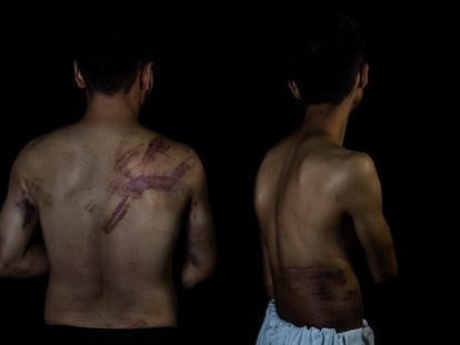 Afghan journalists Neamatullah Naqdi, 28, and Taqi Daryabi, 22, pose for a portrait at Etilaat Roz daily office in Kabul, Afghanistan, Friday, Sept. 10, 2021. The Afghan reporters were detained and beaten by Taliban forces after covering a women's protest in Kabul.  The U.N. human rights office said incidents of Taliban violence against protesters and journalists is increasing.   (AP Photo/Bernat Armangue)
