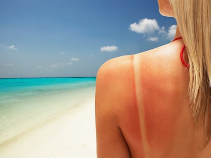 “Me da igual, me voy a poner morena”: la peligrosa obsesión de los adolescentes por conocer el índice UV para perseguir el mayor bronceado
