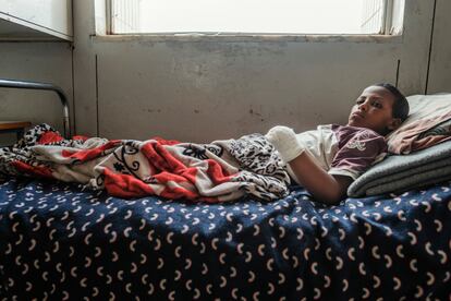 Mekele, 9 de mayo de 2021. Haftom Gebru, de 13 años, descansa en una cama del hospital Ayder, en Mekele. Resultó herido tras caer un proyectil de artillería mientras estaba en su casa, situada en la ciudad de Hawzen. Los médicos tuvieron que cortarle la mano izquierda. Muchos civiles como Haftom fueron atendidos demasiado tarde; en su caso, supuso que hubo que tomar la decisión de amputarle la extremidad.