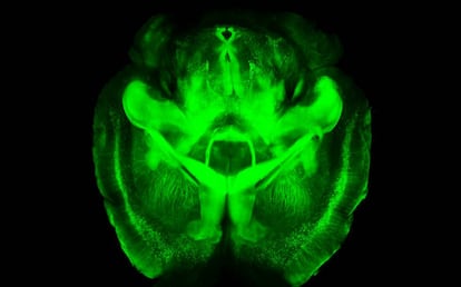 Imagem de um cérebro de camundongo.