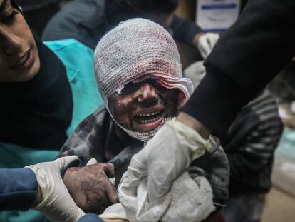 Un niño, víctima de un bombardeo en Deir el-Balah, en el centro de la franja de Gaza, es atendido en un hospital este jueves.