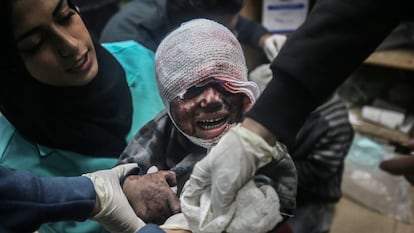 Un niño, víctima de un bombardeo en Deir el-Balah, en el centro de la franja de Gaza, es atendido en un hospital este jueves.