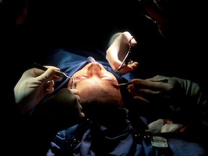 La blefaroplastia, la cirugía de los párpados, es una de las intervenciones más demandadas.