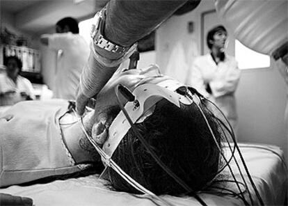 Sesión de terapia electroconvulsiva practicada en el hospital Clínico de Barcelona.