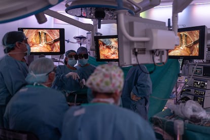 Intervención quirúrgica para extirpar un tumor de recto en el Hospital Clínic de Barcelona.