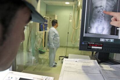 Un agente de la Guardia Civil observa en el hospital Ramón y Cajal la radiografía del estómago de uno de los <i>boleros</i> detenidos en el aeropuerto de Barajas.